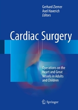 Cardiac Surgery - 