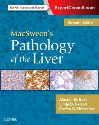 MacSween's Pathology of the Liver - Alastair D. Burt, Linda D. Ferrell, Stefan G. Hübscher