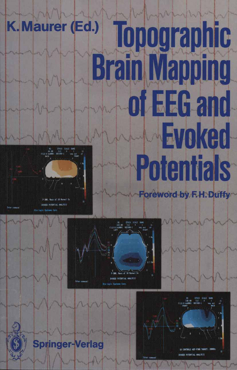 Topographic Brain Mapping of EEG and Evoked Potentials - 