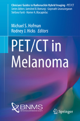 PET/CT in Melanoma - 