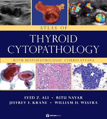 Atlas of Thyroid Cytopathology - Syed Z. Ali, Ritu Nayar, Jeffrey F. Krane, William H. Westra