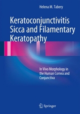 Keratoconjunctivitis Sicca and Filamentary Keratopathy - Helena M. Tabery