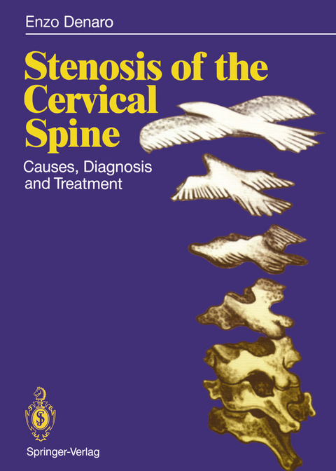 Stenosis of the Cervical Spine - Vincenzo Denaro