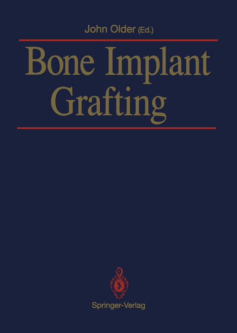 Bone Implant Grafting - 