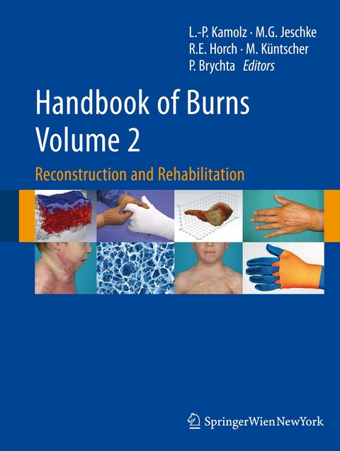 Handbook of Burns Volume 2 - 