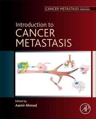 Introduction to Cancer Metastasis - 