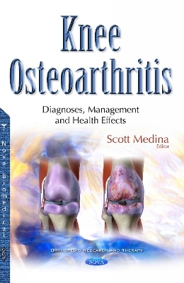 Knee Osteoarthritis - 