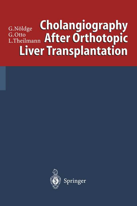 Cholangiography After Orthotopic Liver Transplantation - Gerd Nöldge, Gerd Otto, Lorenz Theilmann