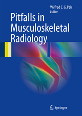 Pitfalls in Musculoskeletal Radiology - 