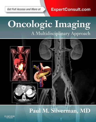 Oncologic Imaging: A Multidisciplinary Approach - 