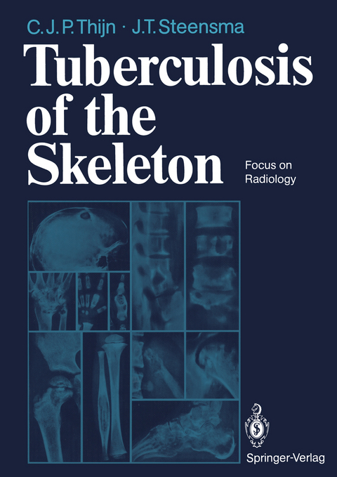 Tuberculosis of the Skeleton - Cornelis J.P. Thijn, Jieldouw T. Steensma