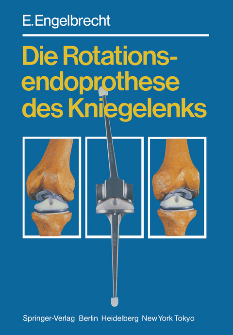 Die Rotationsendoprothese des Kniegelenks - E. Engelbrecht