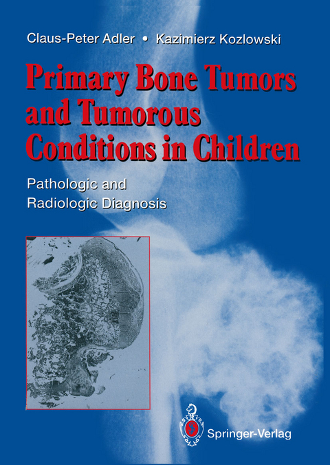 Primary Bone Tumors and Tumorous Conditions in Children - Claus-Peter Adler, Kazimierz Kozlowski