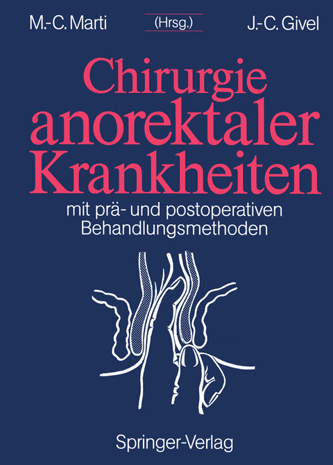 Chirurgie anorektaler Krankheiten - 