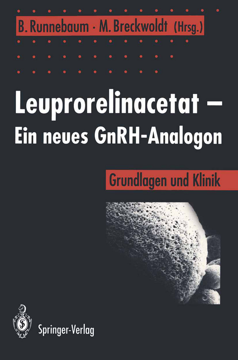 Leuprorelinacetat — Ein neues GnRH-Analogon - 