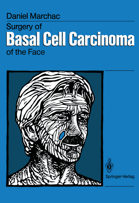 Surgery of Basal Cell Carcinoma of the Face - Daniel Marchac