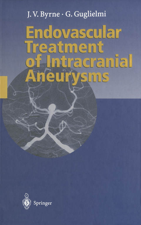 Endovascular Treatment of Intracranial Aneurysms - James Byrne, Guido Guglielmi