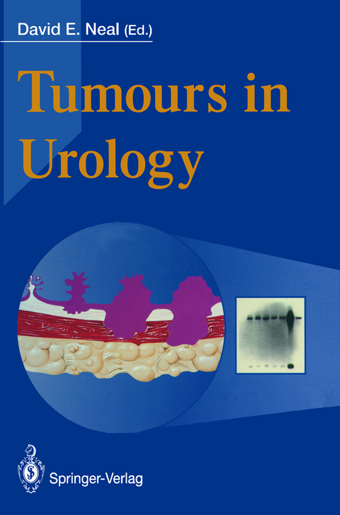 Tumours in Urology - 