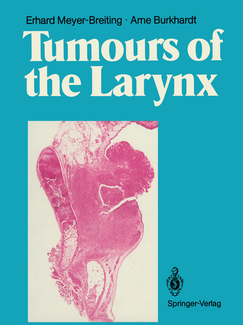 Tumours of the Larynx - Erhard Meyer-Breiting, Arne. Burkhardt