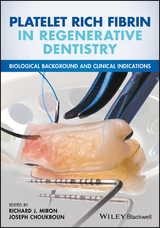 Platelet Rich Fibrin in Regenerative Dentistry - 