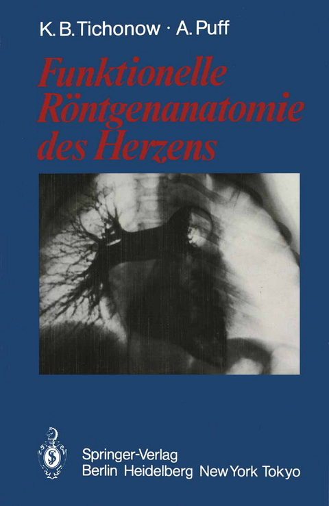 Funktionelle Röntgenanatomie des Herzens - Konstantin B. Tichonow, Alexander Puff