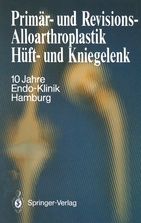 Primär- und Revisions-Alloarthroplastik Hüft- und Kniegelenk - 