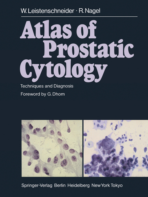 Atlas of Prostatic Cytology - W. Leistenschneider, R. Nagel