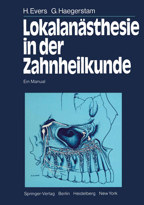 Lokalanästhesie in der Zahnheilkunde - H. Evers, G. Haegerstam