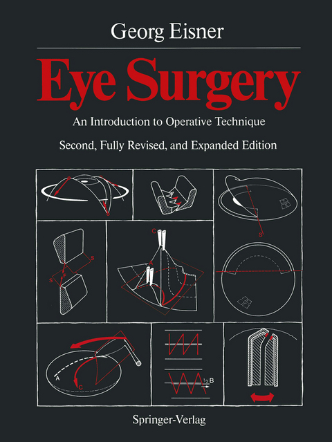 Eye Surgery - Georg Eisner