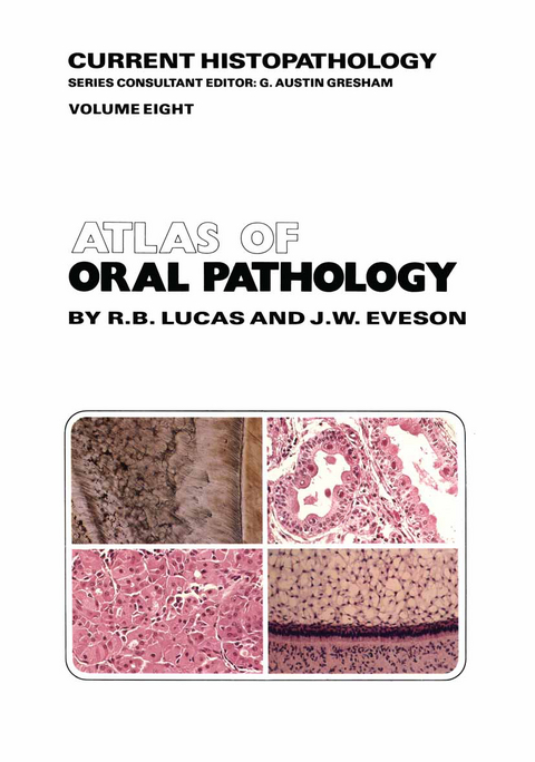 Atlas of Oral Pathology - R.B. Lucas, J.W. Eveson