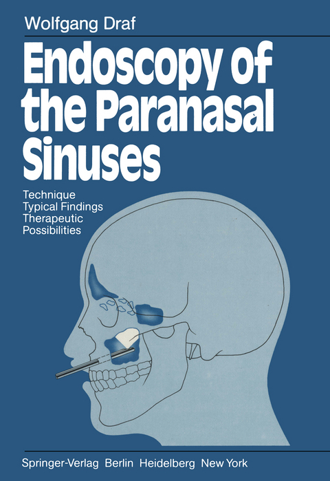 Endoscopy of the Paranasal Sinuses - Wolfgang Draf