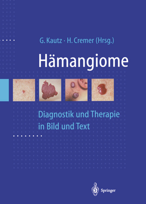 Hämangiome - 