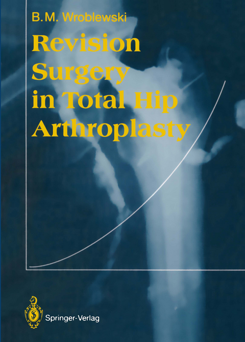 Revision Surgery in Total Hip Arthroplasty - Boguslaw M. Wroblewski