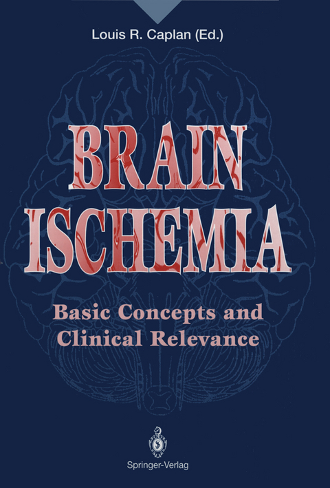 Brain Ischemia - 