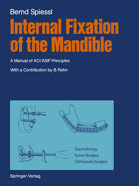 Internal Fixation of the Mandible - Bernd Spiessl