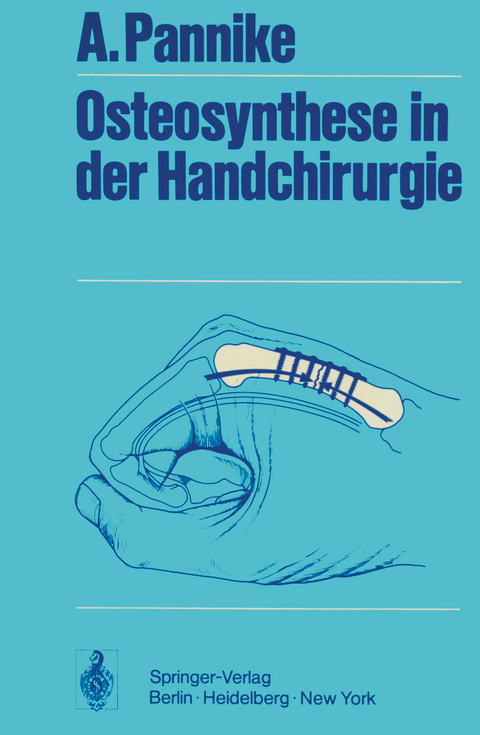 Osteosynthese in der Handchirurgie - A. Pannike