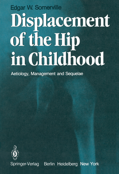 Displacement of the Hip in Childhood - E.W. Somerville