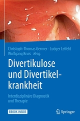 Divertikulose und Divertikelkrankheit - 