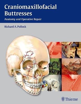 Craniomaxillofacial Buttresses - 