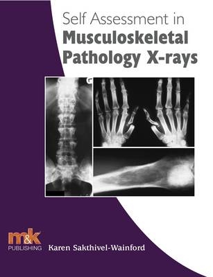 Self Assessment in Musculoskeletal Pathology X-rays - Karen Sakthivel-Wainford