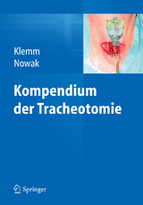 Kompendium der Tracheotomie - 