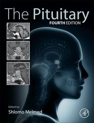 The Pituitary - 