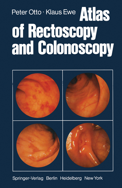 Atlas of Rectoscopy and Coloscopy - P. Otto, K. Ewe