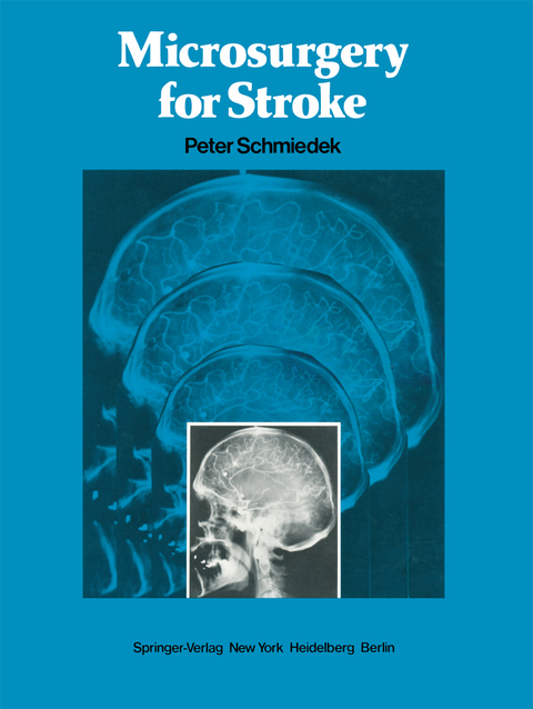 Microsurgery for Stroke - 