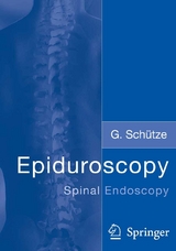 Epiduroscopy - Günter Schütze