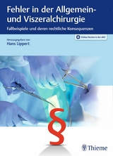 Fehler in der Allgemein- und Viszeralchirurgie - 