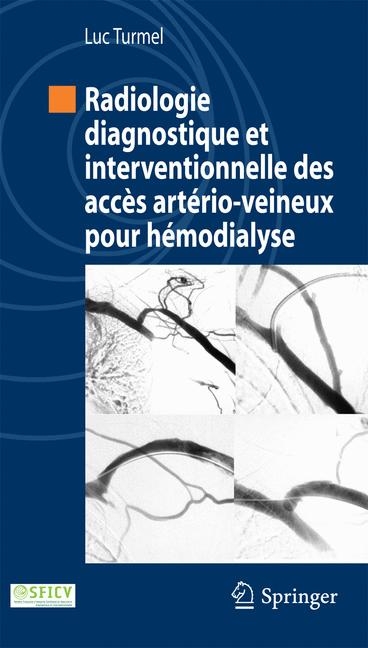 Radiologie Diagnostique Et Interventionnelle Des Accès Artério-Veineux Pour Hémodialyse - Luc Turmel