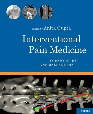 Interventional Pain Medicine - 