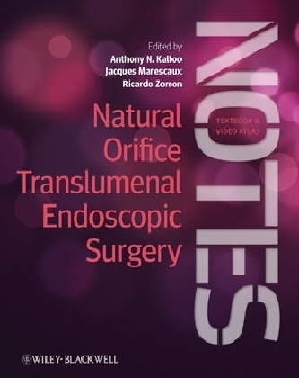 Natural Orifice Translumenal Endoscopic Surgery (NOTES), Textbook and Video Atlas - 