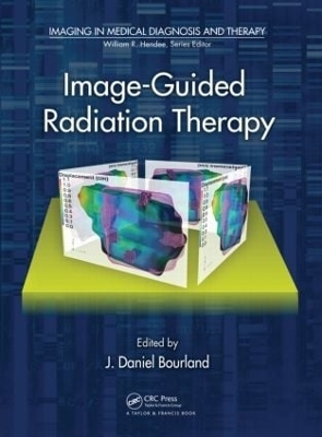 Image-Guided Radiation Therapy - 